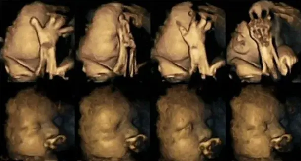 Główne zdjęcie - Nie zabijaj swojego dziecka - nie pal w ciąży!