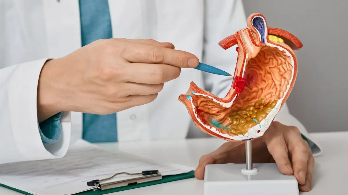 Lekarz pokazujący na modelu żołądek