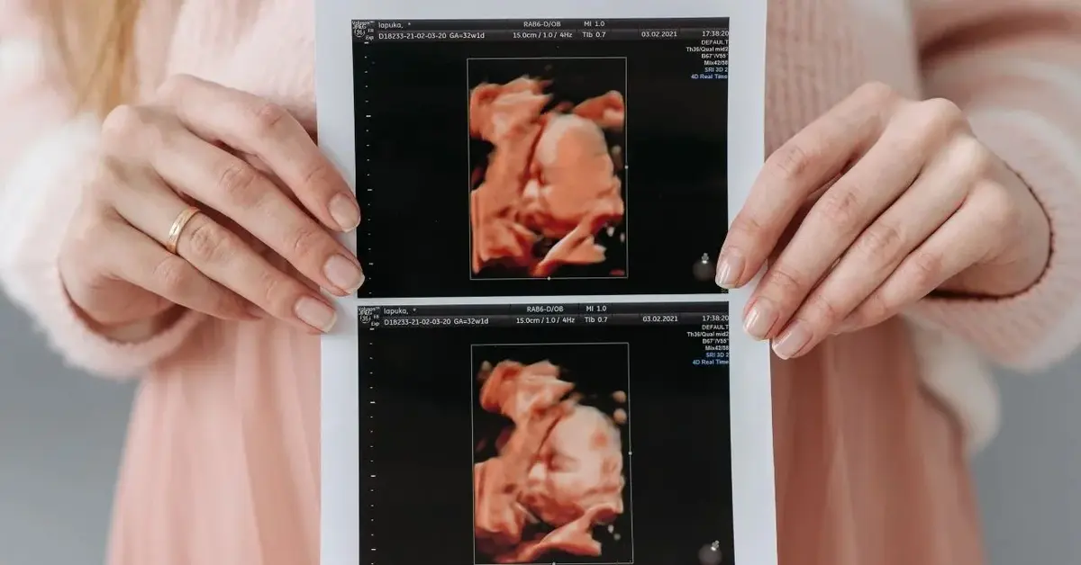 Kobieta w ciąży pokazuje zdjęcie