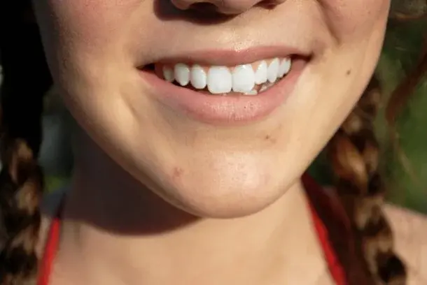 5 sposobów na wybielenie zębów – pasty i żele