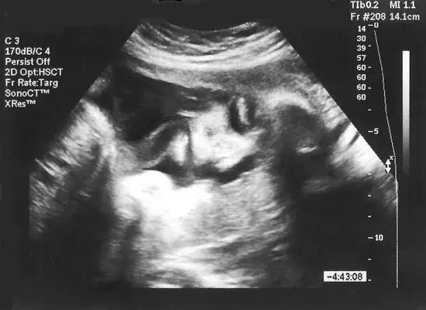 Krótki kalendarz ciąży – 10 najważniejszych wydarzeń w 1 trymestrze