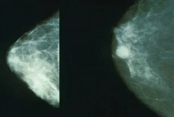 Główne zdjęcie - Badania profilaktyczne dla kobiet – cytologia, mammografia i inne