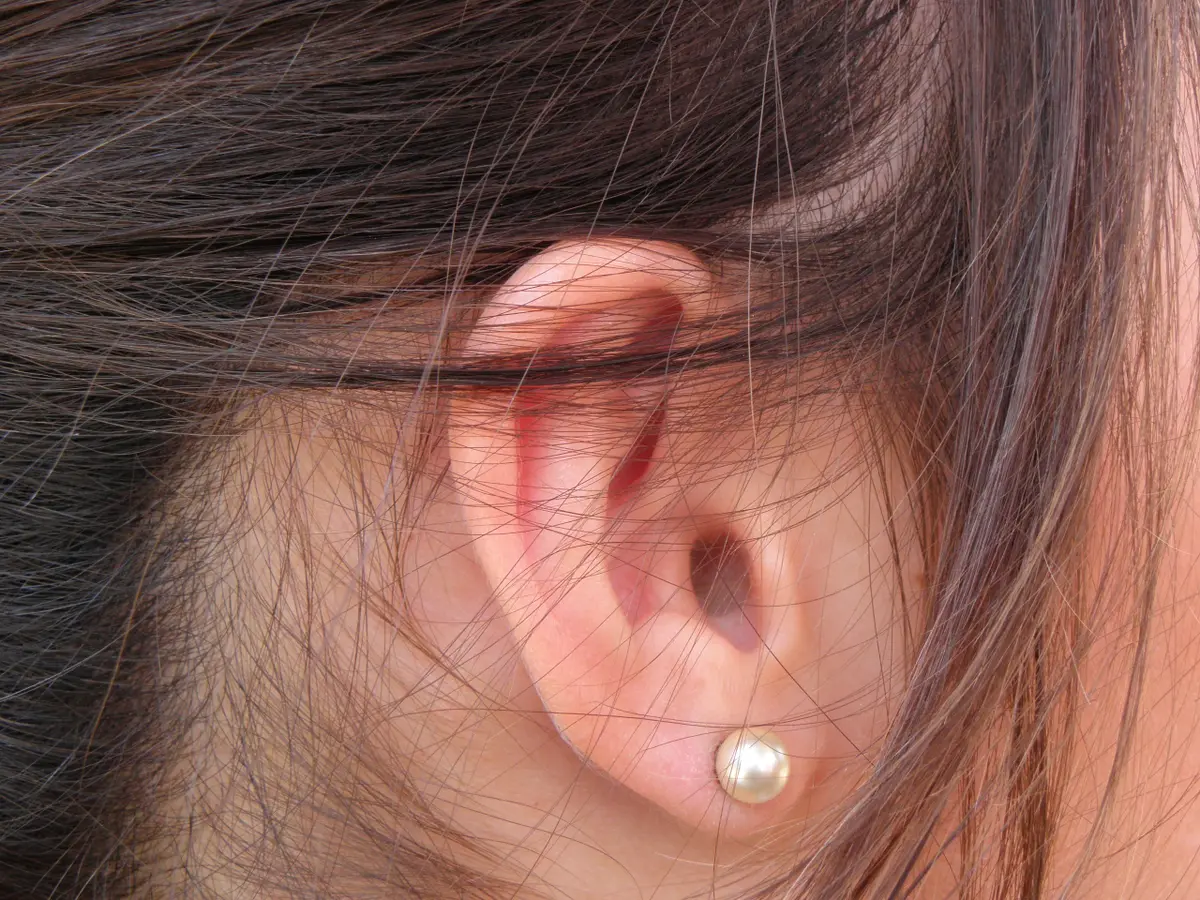 Główne zdjęcie - 10 sposobów leczenia zapalenia ucha