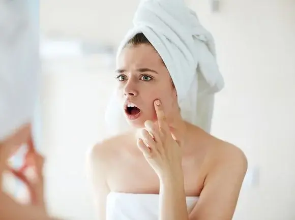 3 wskazówki, jak pielęgnować cerę naczynkową