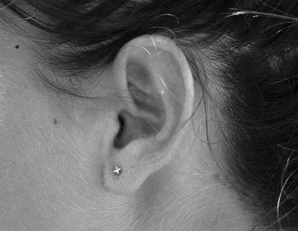 5 domowych sposobów na bolące uszy