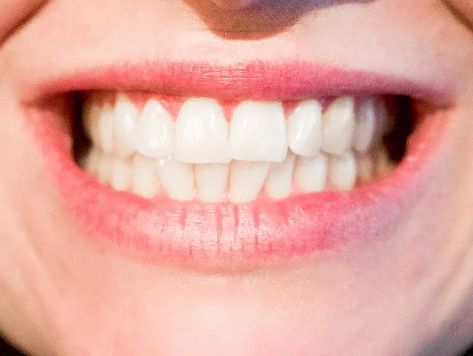 Główne zdjęcie - 6 domowych sposobów, które pomogą Ci wybielić zęby
