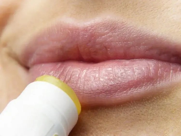 Spierzchnięte i popękane usta - sposoby na regenerację wysuszonych ust