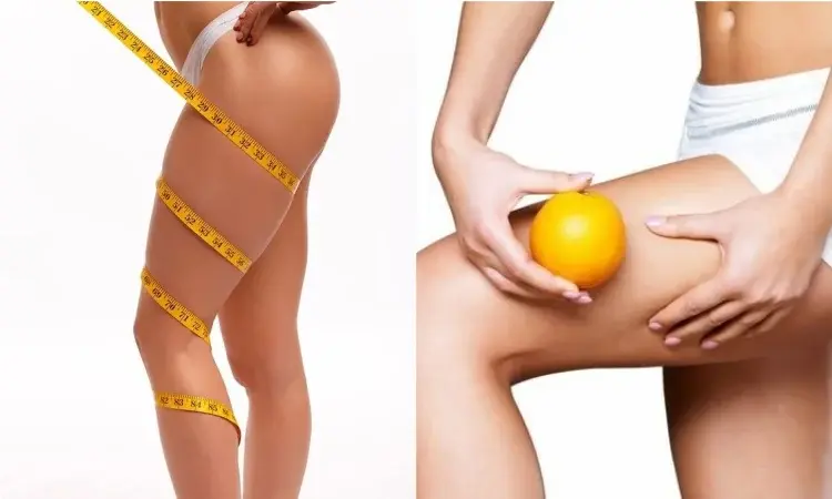 Kosmetyczny detoks po zimie - skuteczne kosmetyki, które ujędrnią ciało i zwalczą cellulit