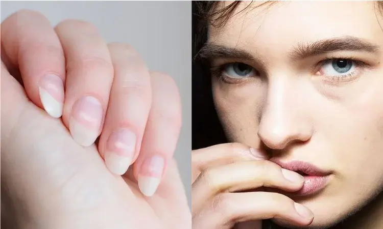 Białe plamki na paznokciach - co oznaczają? Jak sobie z nimi poradzić?