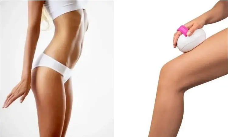 Jak się pozbyć CELLULITU? 6 niezawodnych metod na zlikwidowanie skórki pomarańczowej