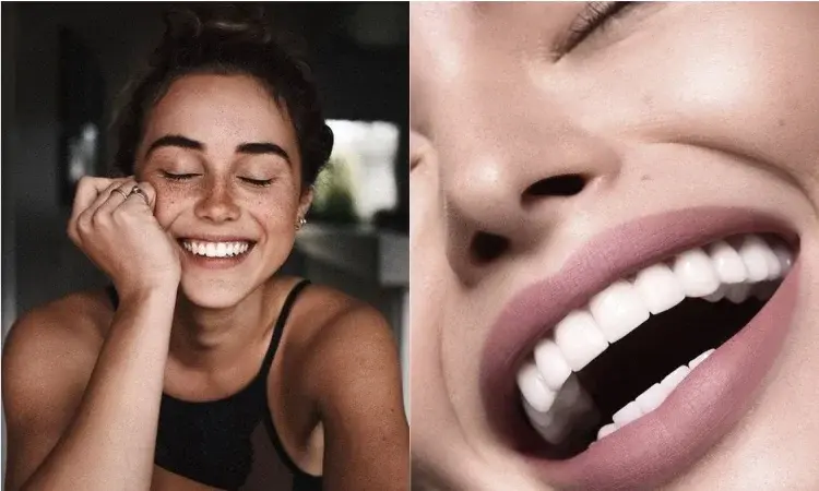 Biała dieta: Co można jeść po wybielaniu zębów?