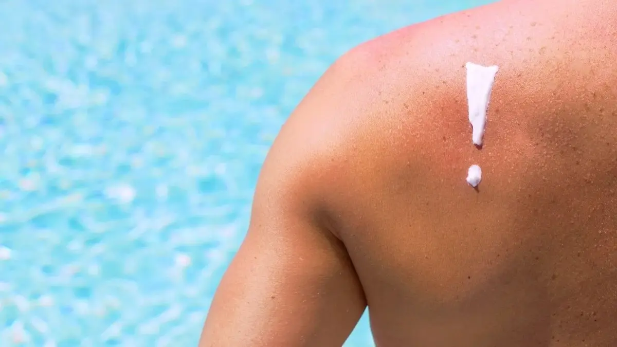 Uczulenie na słońce