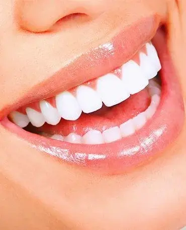 Biała dieta: Co można jeść po wybielaniu zębów?