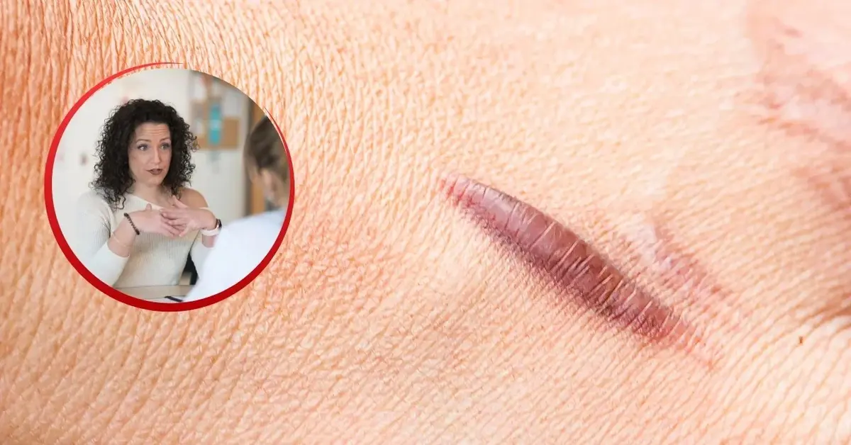 Kobieta rozmawia o bliznowcach z lekarzem.