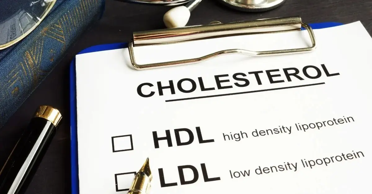 Główne zdjęcie - Jak obniżyć poziom cholesterolu w swoim organizmie?