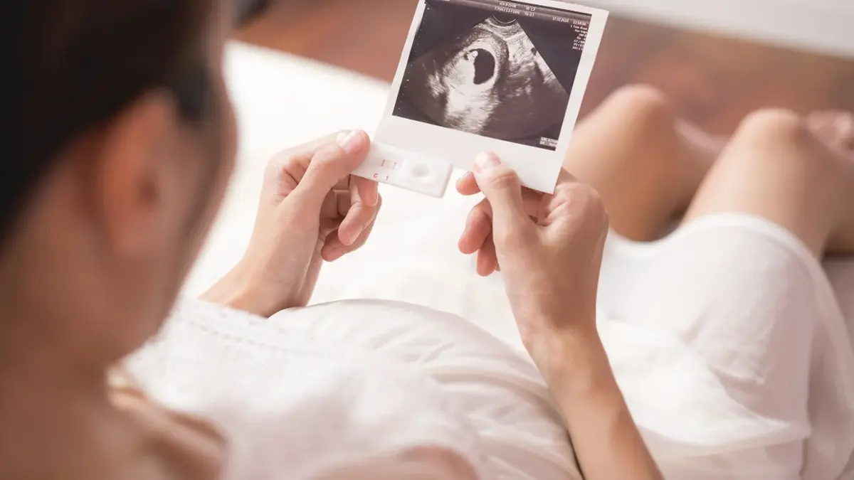Kobieta w ciąży trzymająca zdjęcie usg