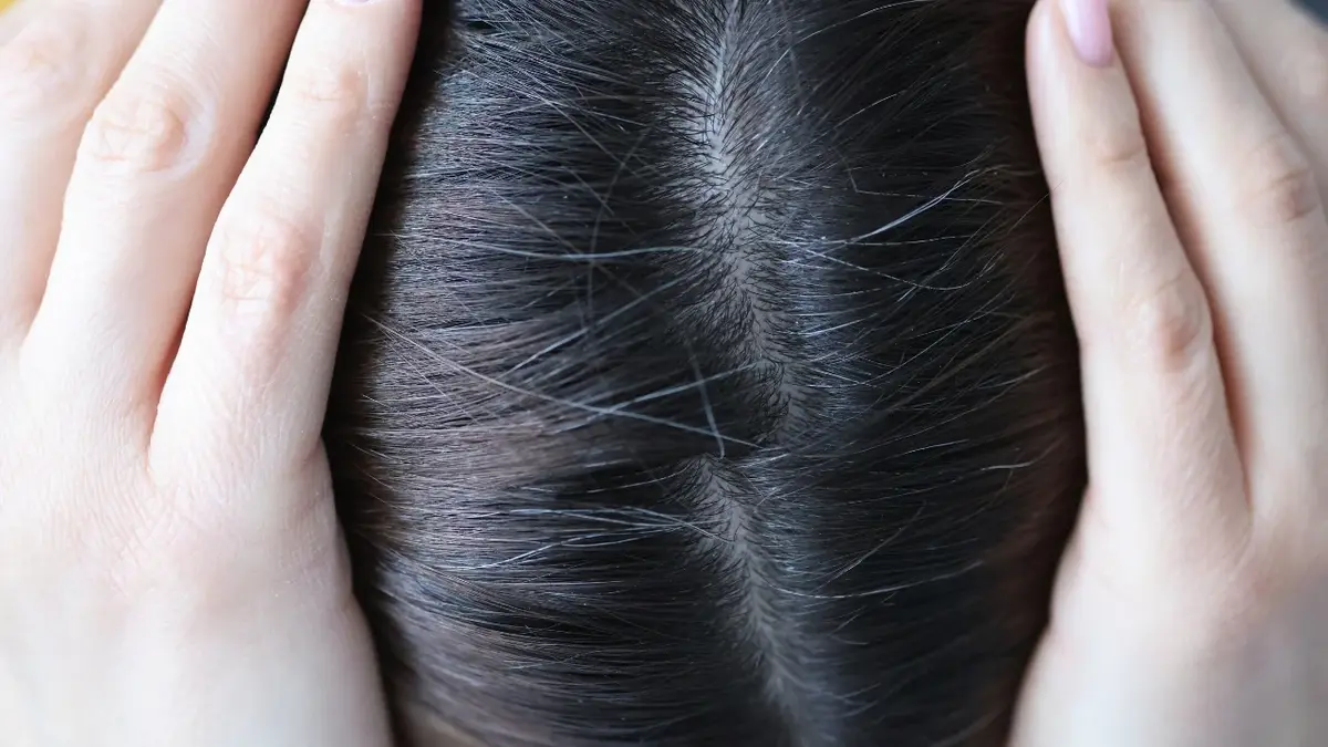 Czubek głowy kobiety z widocznymi siwymi włosami 