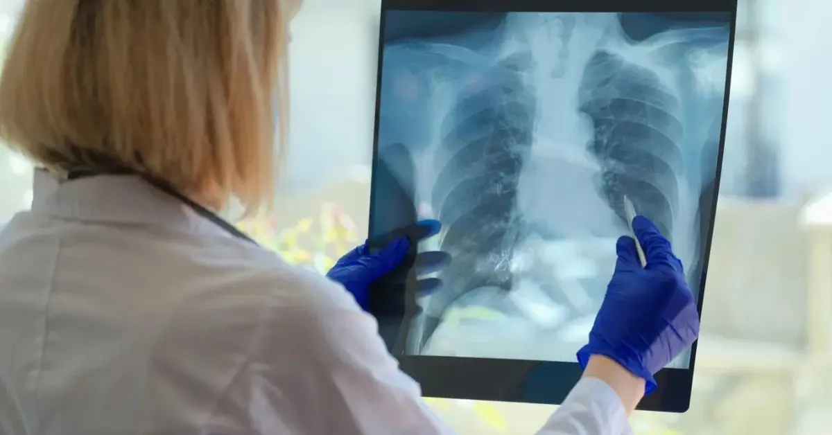 Kobieta lekarka patrząca na zdjęcie rentgenowskie pluc