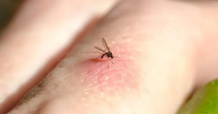 Główne zdjęcie - "Komary gryzą ludzi tylko ze słodką krwią" - obalamy mit. Oto powód, dlaczego komary Cię "lubią"