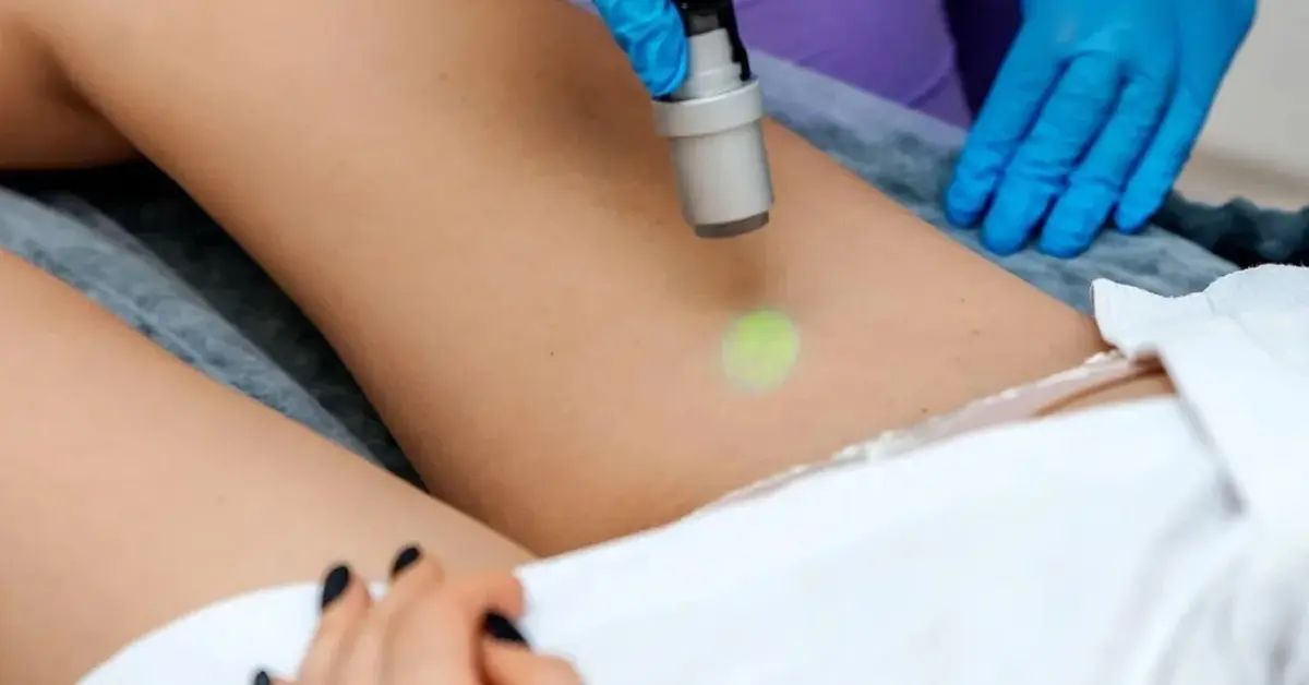 Kobieta w trakcie zabiegu depilacji laserowej