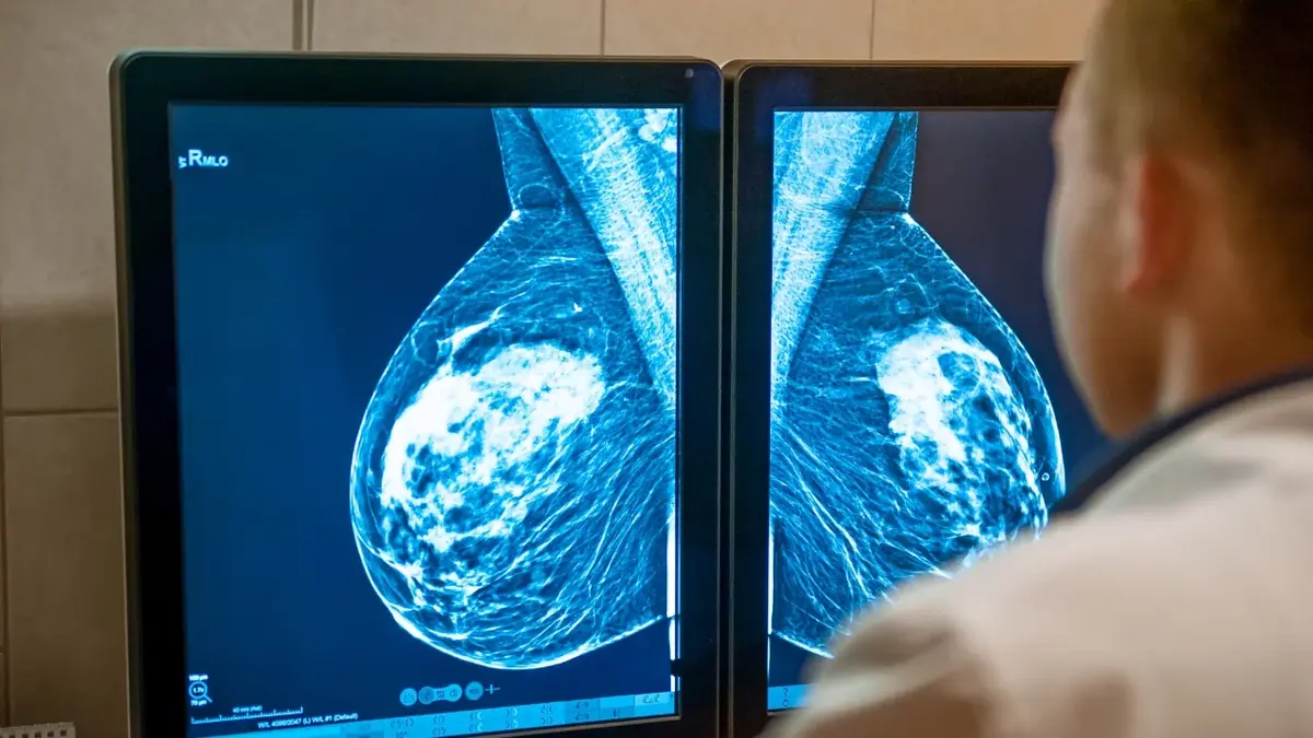 lekarz ogląda zdjęcie piersi z badania mammograficznego