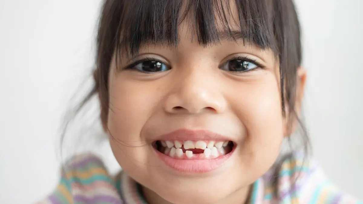 dziewczynka pokazuje zęby z jednym brakującym