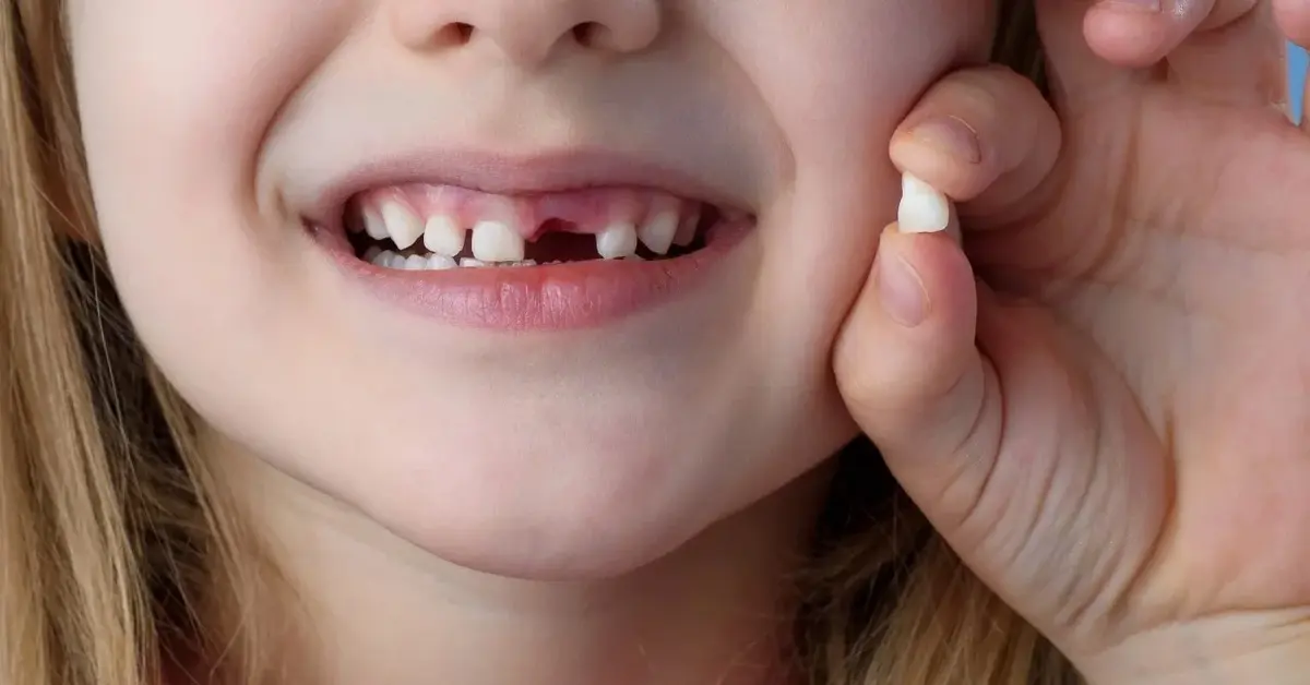 dziewczynka trzyma swojego mleczaka w palcach i pokazuje zęby