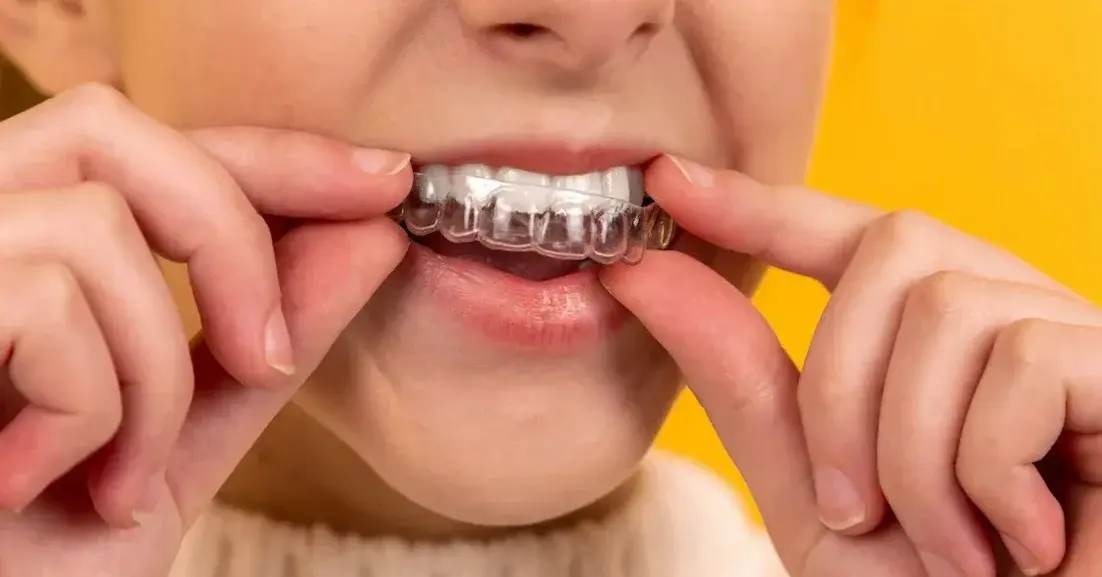 Uśmiech dziewczynki w białym swetrze zakładającej przeźroczystą nakładkę ortodontyczną