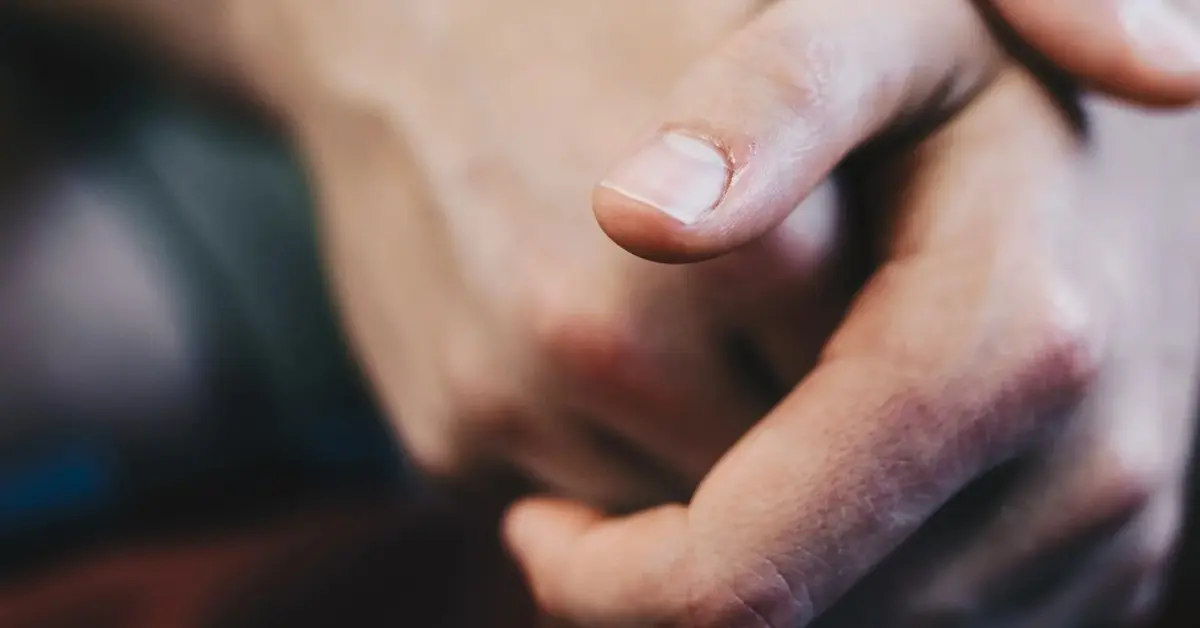 Dłonie z krótkimi, naturalnymi paznokciami