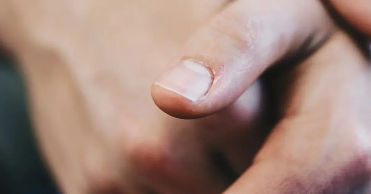 Dłonie z krótkimi, naturalnymi paznokciami