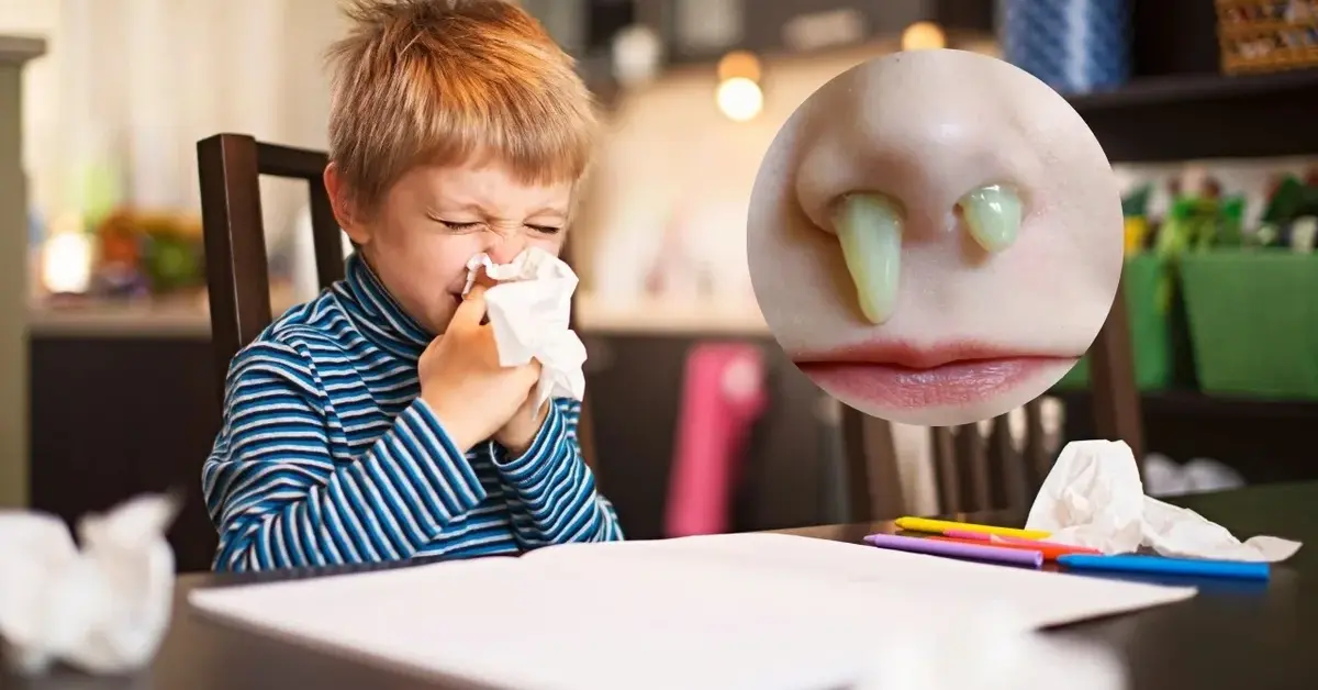 Przeziębionych chłopiec wyciera nos. Zdjęcie wydzieliny z nosa.