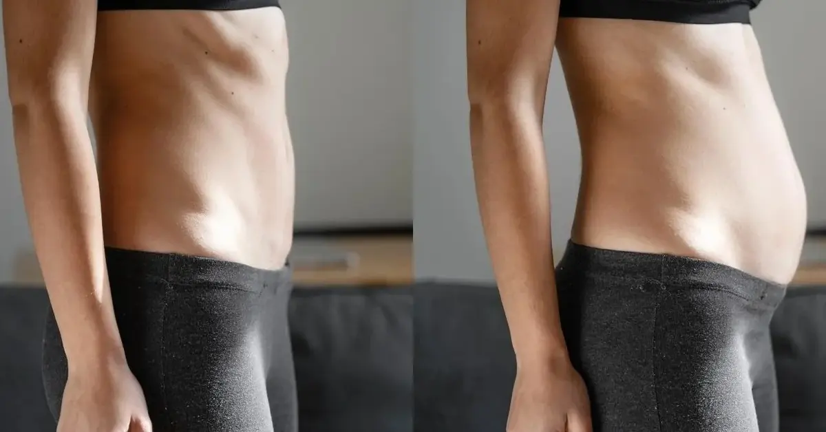 Kobieta ma wzdęcia od zatrzymania wody w organizmie.