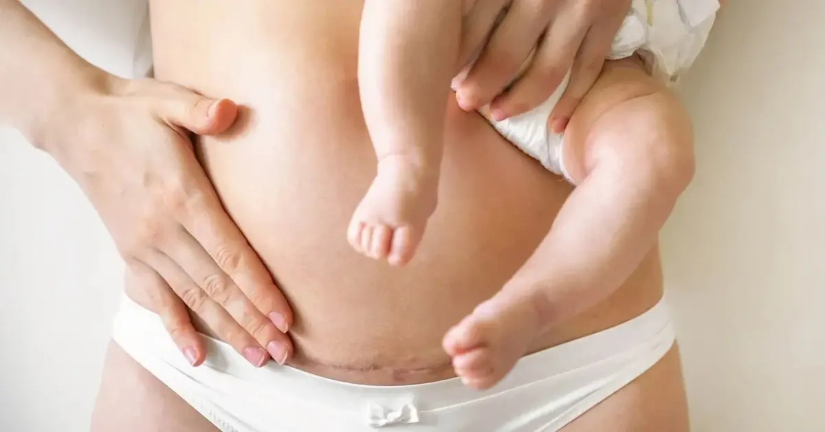 Kobieta trzymająca na brzuchu dziecko