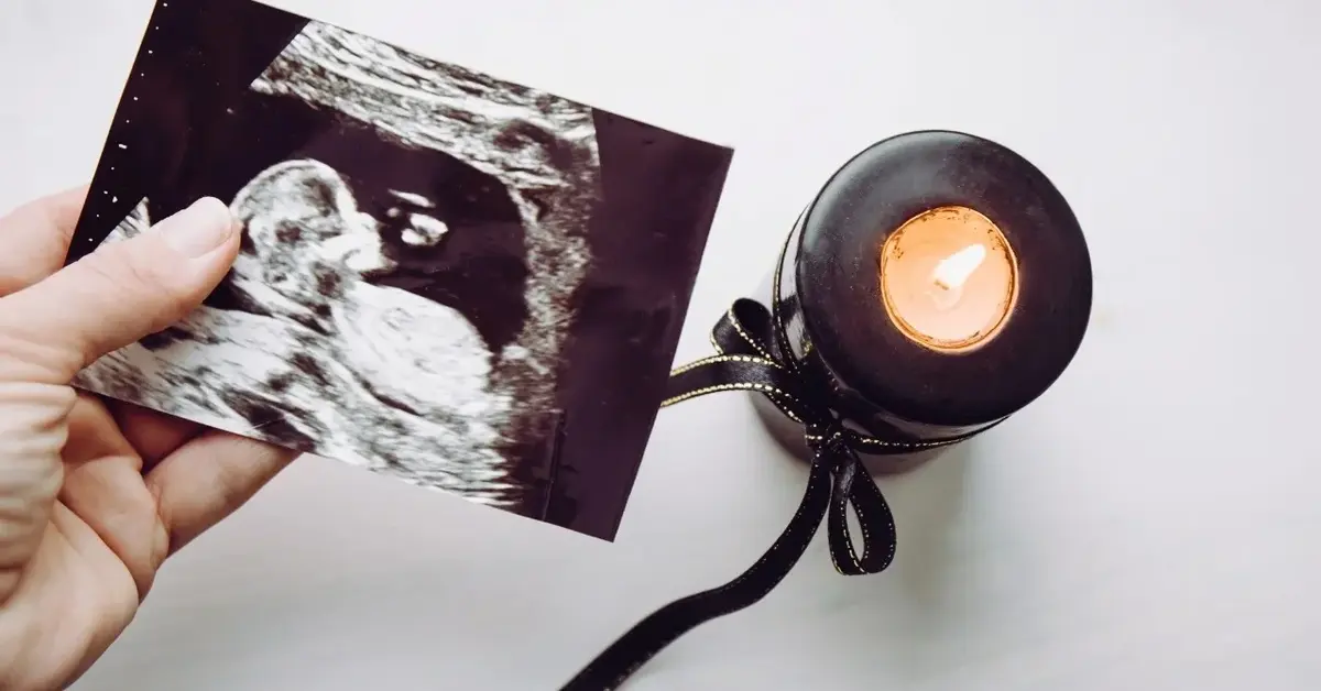 Zdjęcie usg dziecka trzymane w ręce, obok czarna świeczka 