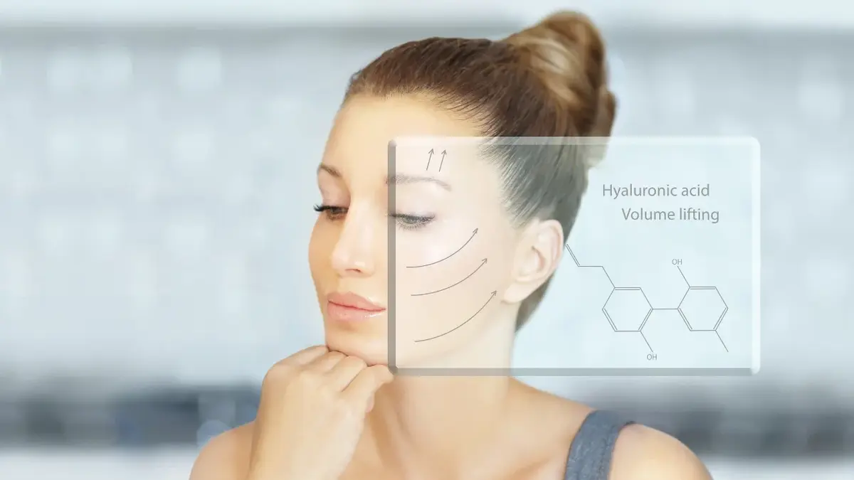 Kobieta z zaznaczonymi graficznie liniami pokazującymi działanie kwasu hialuronowego